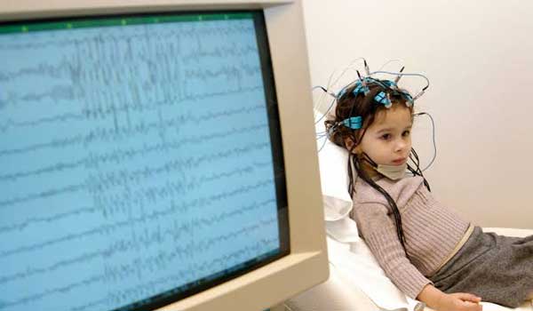 Video EEG (electroencephalogram) 